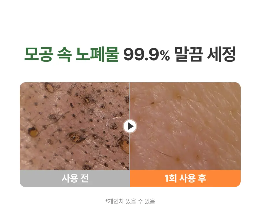 [NEW/딱풀팩] 닥터지 그린딥 포어 아보카도 팩 투 폼 150ml 상세페이지 13